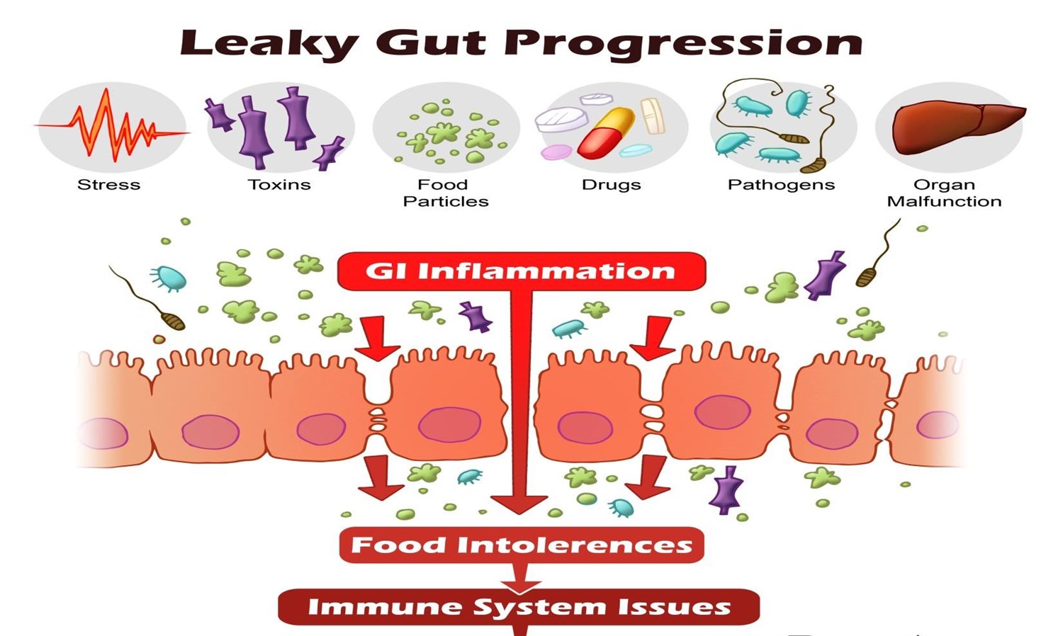 Leaky Gut with Dr. Cheryl Burdette from Dunwoody Labs image