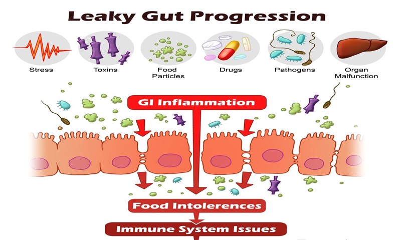 Leaky Gut with Dr. Cheryl Burdette from Dunwoody Labs