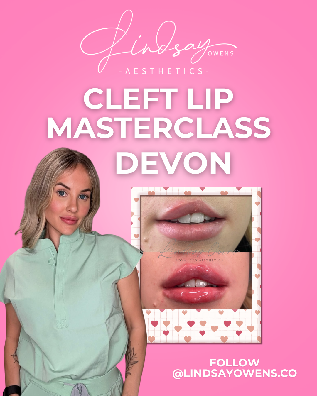 Cleft Lip Masterclass - Devon image