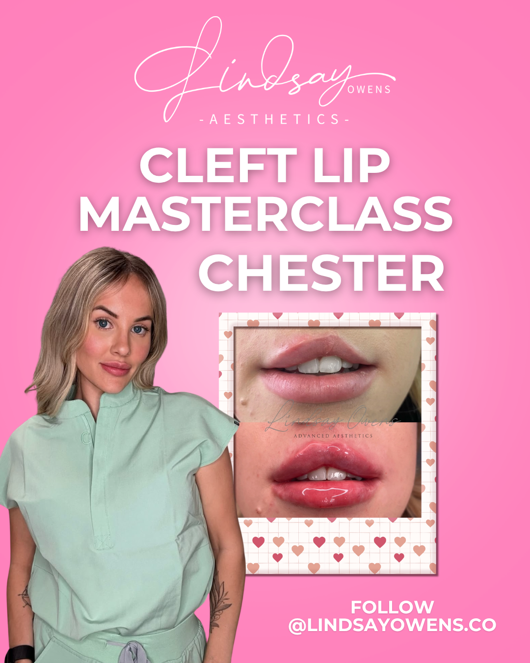 Cleft Lip Masterclass - Chester image