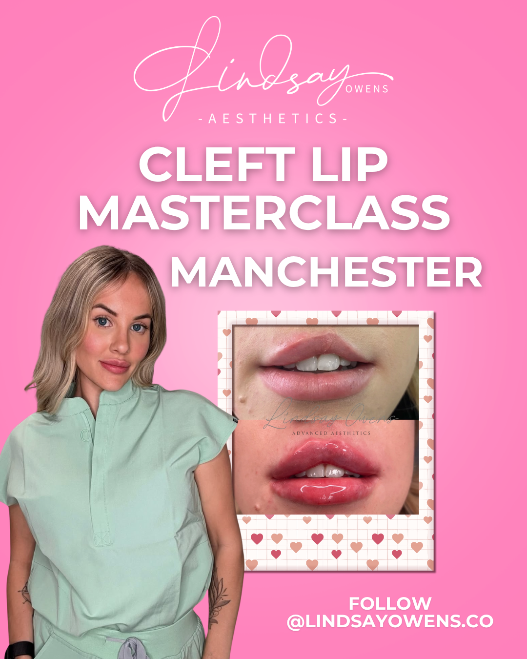 Cleft Lip Masterclass - Manchester image