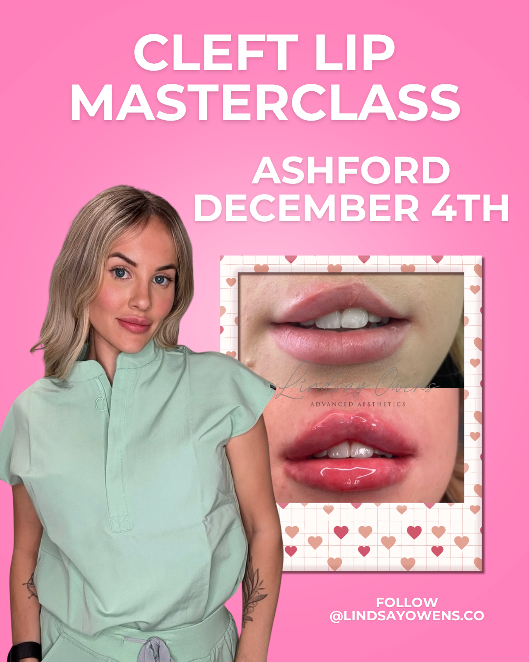 Cleft Lip Masterclass - Ashford image