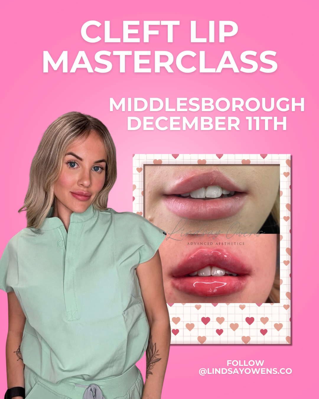 Cleft Lip Masterclass - Middlesbrough image
