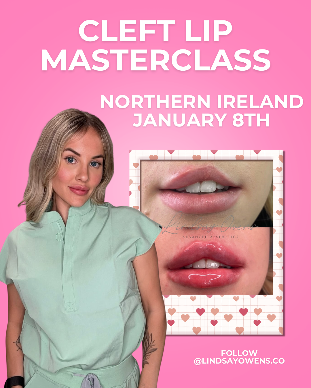 Cleft Lip Masterclass - Northern Ireland image