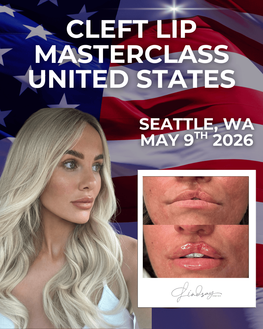 Cleft Lip Filler Masterclass - Seattle, WA image