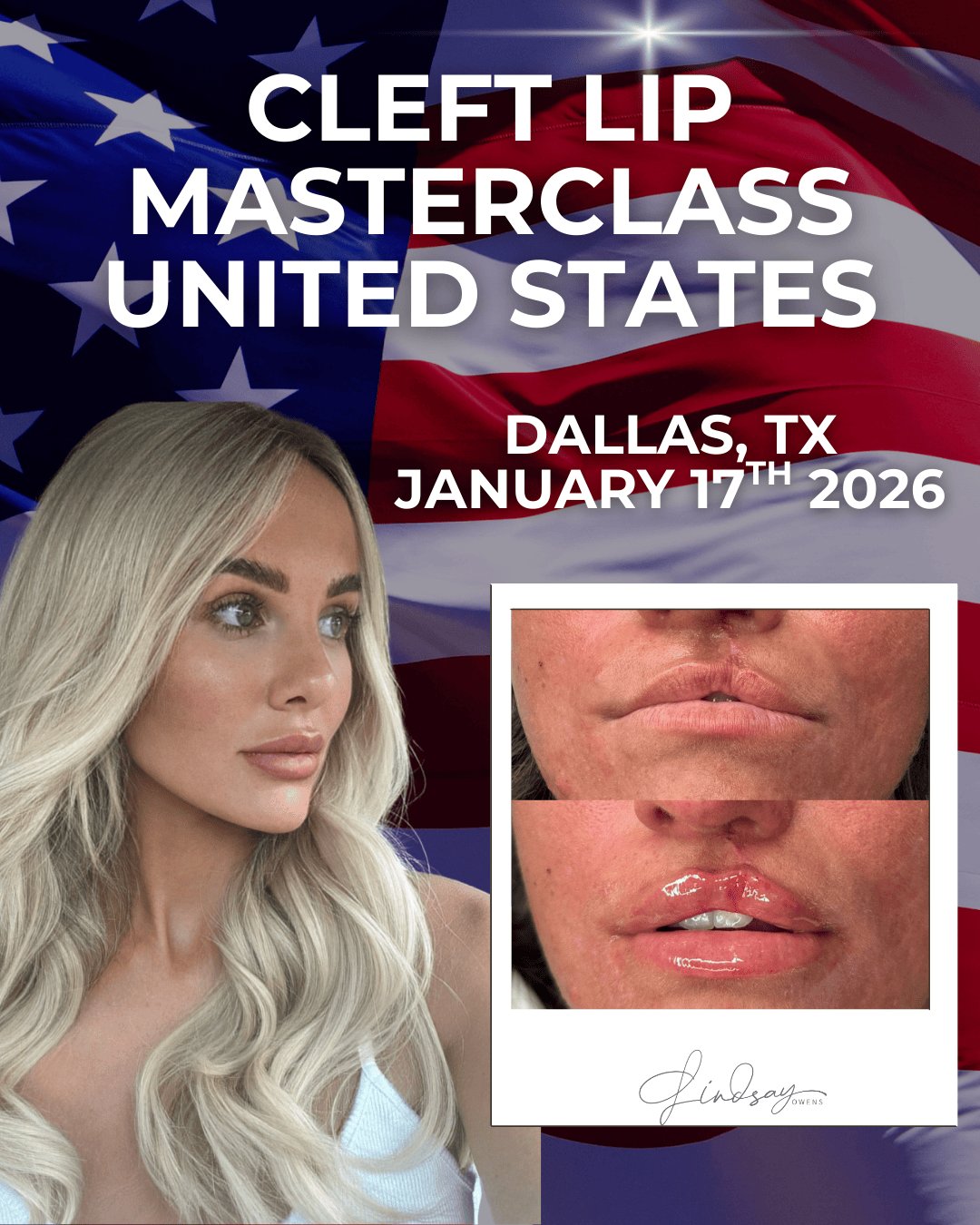 Cleft Lip Filler Masterclass - Dallas, TX image