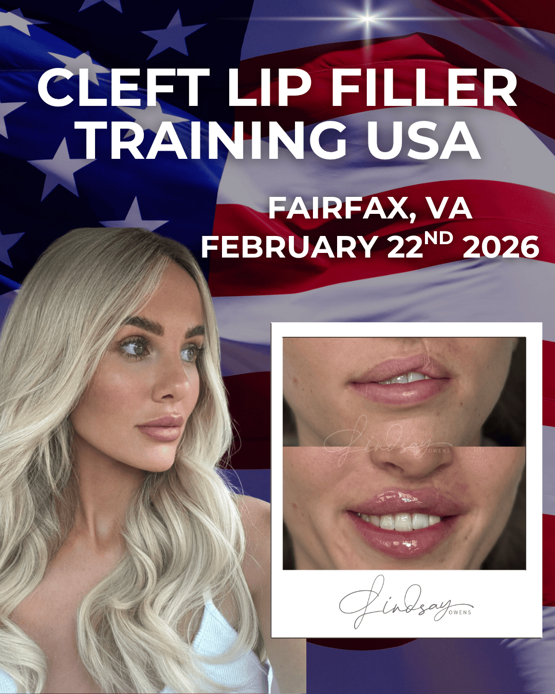 Cleft Lip Filler Masterclass - Fairfax, VA image