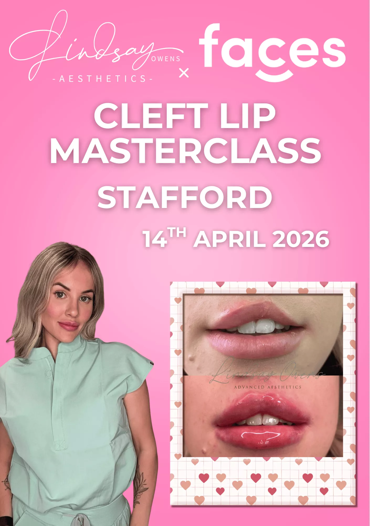 Cleft Lip Masterclass - Stafford image